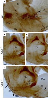 Gli2-Mediated Shh Signaling Is Required for Thalamocortical Projection Guidance